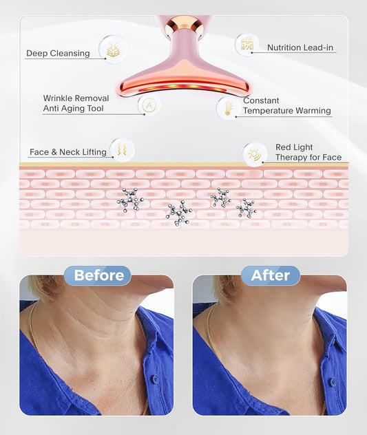 Get Rid of that Double Chin and Turkey Neck